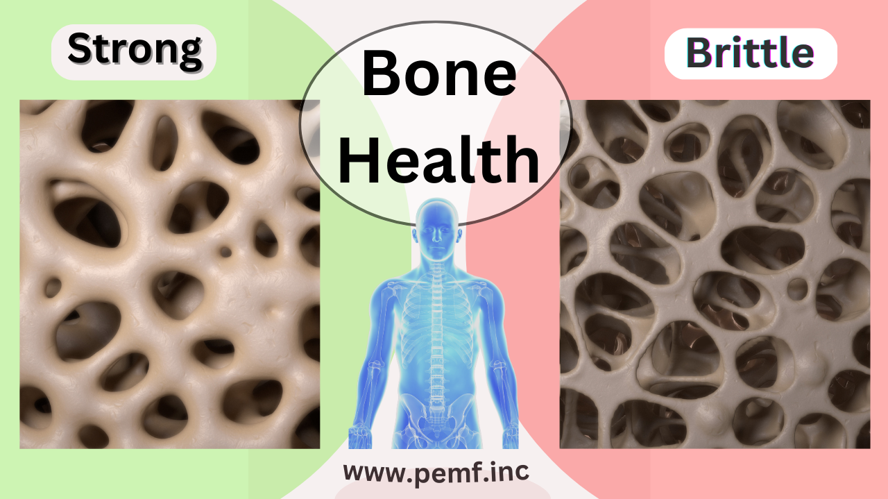 Improving Your Bone Density Through PEMF Therapy Machines